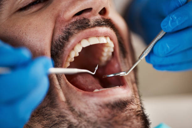 Best Periodontal (Gum) Disease Treatment  in St John, KS